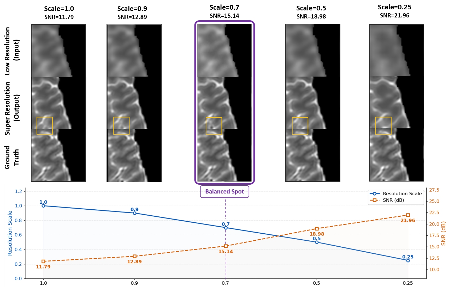 Figure 1: Illustration of the trade-off between spatial resolution and signal-to-noise ratio (SNR) under a simulated ultra-low MRI system (64 mT). In the high-resolution but low-SNR setting, severe noise leads to fragmented and discontinuous anatomical structures, as highlighted in the yellow boxes. The balanced regime produces more coherent and structurally consistent reconstructions, closely matching the HR reference. In the low-resolution but high-SNR setting, structures appear over-smoothed, and fine anatomical details are lost due to partial volume effects.