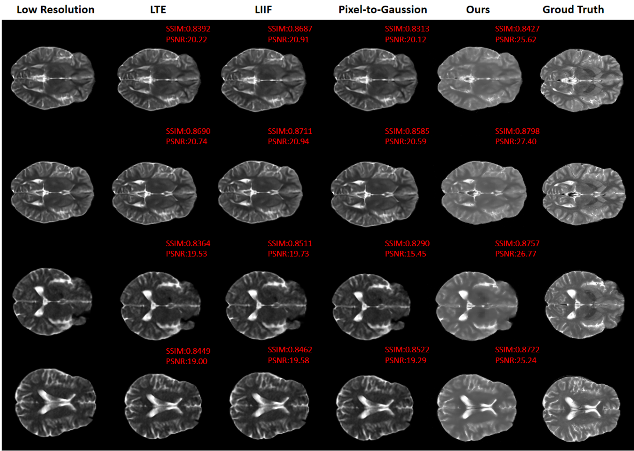 Figure 6: Visual comparison on real 64mT-3T dataset. The SR results of our method can recover fine details from the Ground Truth.