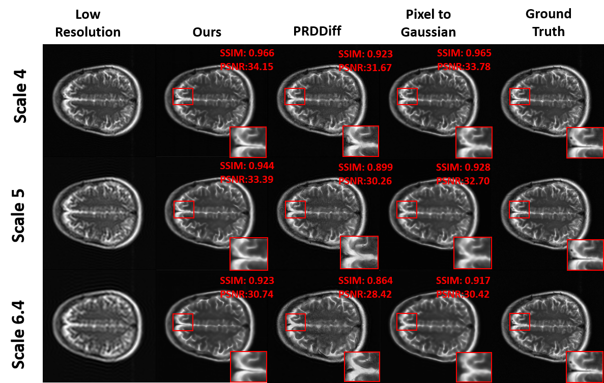 Figure 7: Visual comparison on the fastMRI benchmark at scales \times​4, \times​5, and \times​6.4. Our method consistently recovers fine anatomical structures (e.g, the inter-hemispheric fissure between the left and right cerebral hemispheres) that are lost by competing methods. Pixel-to-Gaussian produces over-smoothed reconstructions, while PRDDIFF suffers from residual noise and inferior anatomical fidelity and structural consistency.