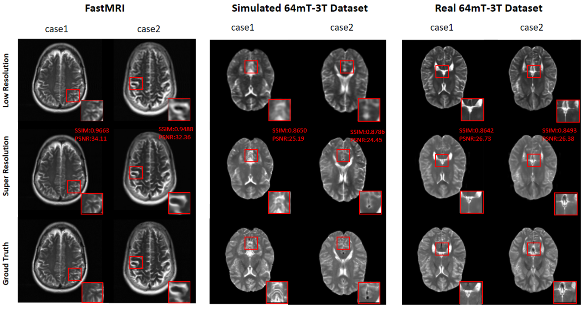 Figure 5: The qualitative results on three simulated datasets under the optimal input resolution. Our method reconstructs fine details of the Ground Truth on these datasets. Red boxes highlight regions for detailed comparison.