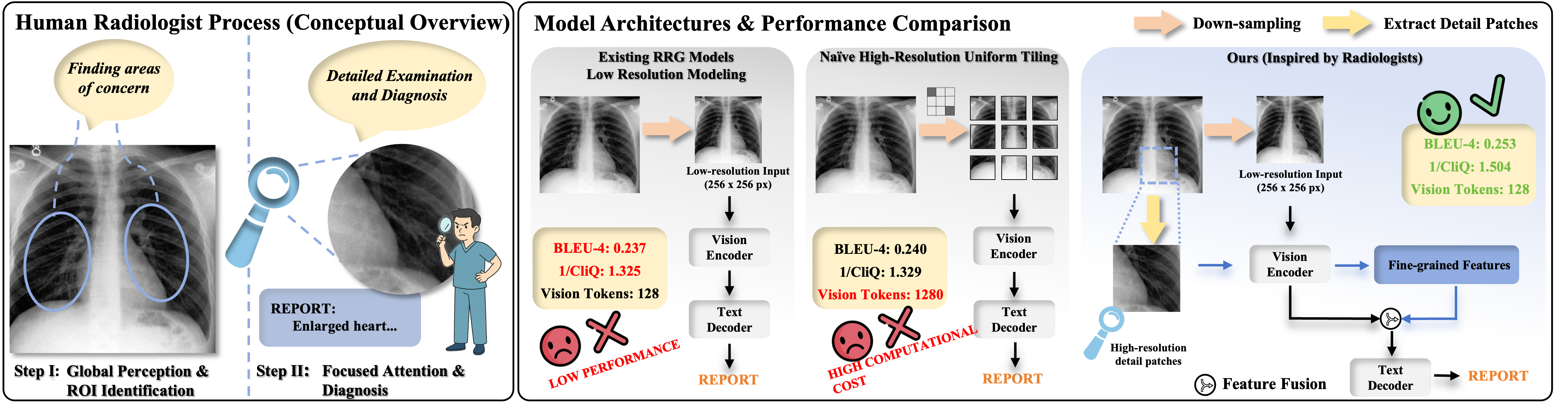 Figure 1: Left: Radiologists typically follow a two-stage workflow: a global survey to localize suspicious regions, followed by focused examination of these areas to verify specific findings (e.g., enlarged heart). Right: Conventional RRG models rely on fixed-size, low-resolution inputs and lack this global–local reasoning process. Our radiologist-inspired framework instead extracts and integrates high-resolution regional details, producing reports with improved clinical fidelity.