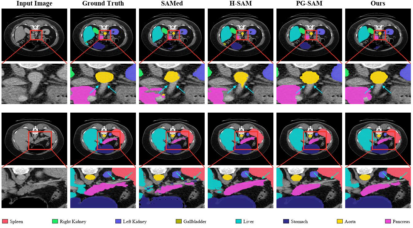 Figure 4: Qualitative comparison of segmentation results produced by different methods on the Synapse dataset, with particular focus on the aorta and pancreas.