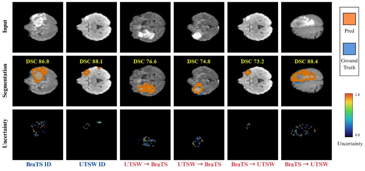 Figure 6: Segmentation and context-instability visualization. For representative ID and OOD cases, the top row shows the input MRI slice, the middle row overlays prediction and ground truth, and the bottom row shows CCT uncertainty.
