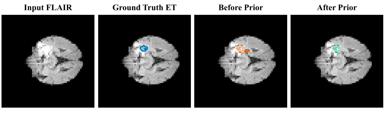 Figure 3: Structural-prior visualization. Example prediction before and after applying the anatomy-aware structural prior.