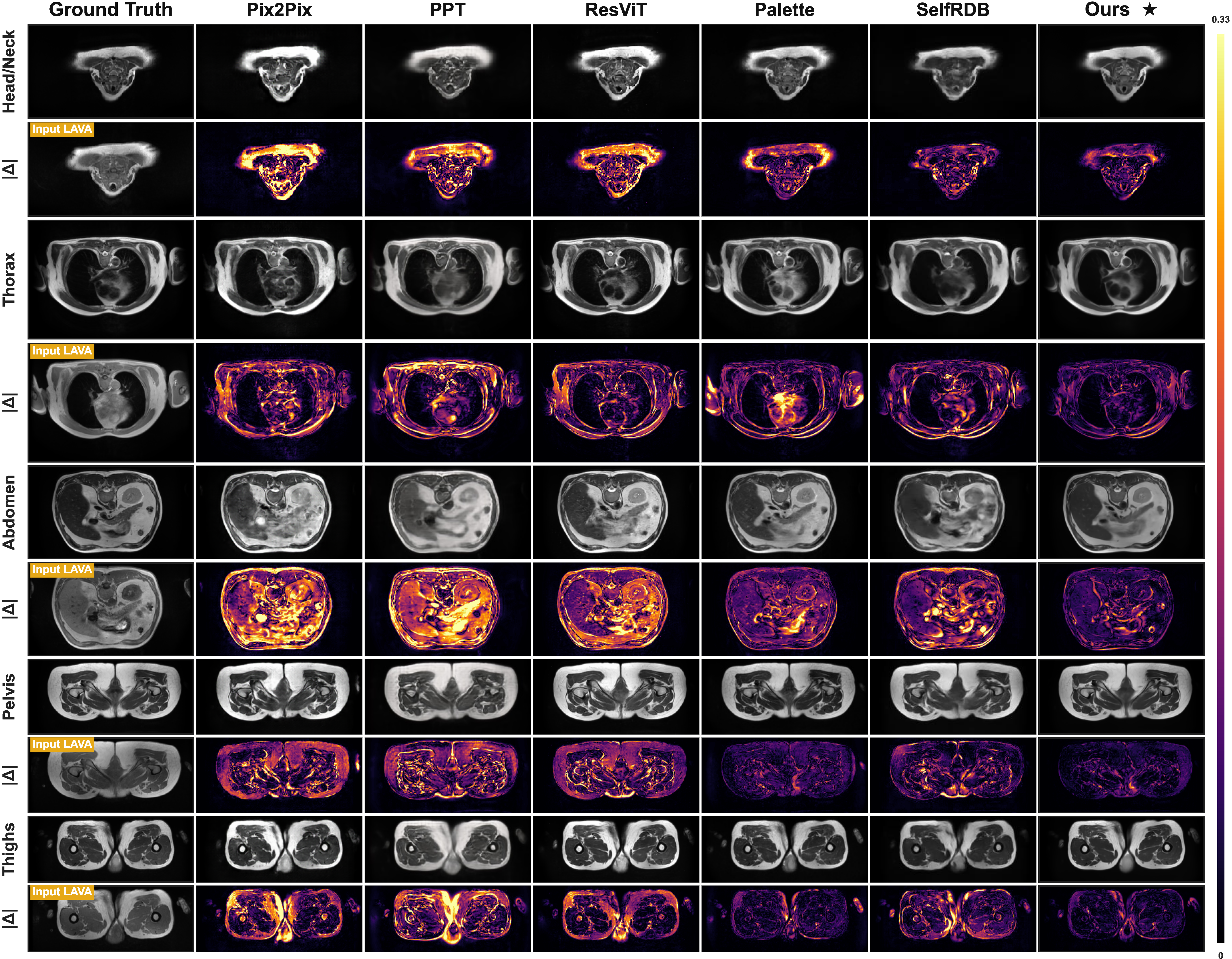Figure 2: Qualitative comparison across five anatomical regions. Top row: translated T2w results; bottom row: absolute error maps |\hat{\mathbf{x}}-\mathbf{x}_{\mathrm{GT}}|.