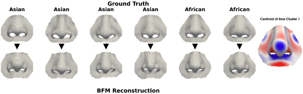 Figure 8: Example of African and Asian subjects affected by a failure mode 1 of BFM [23].