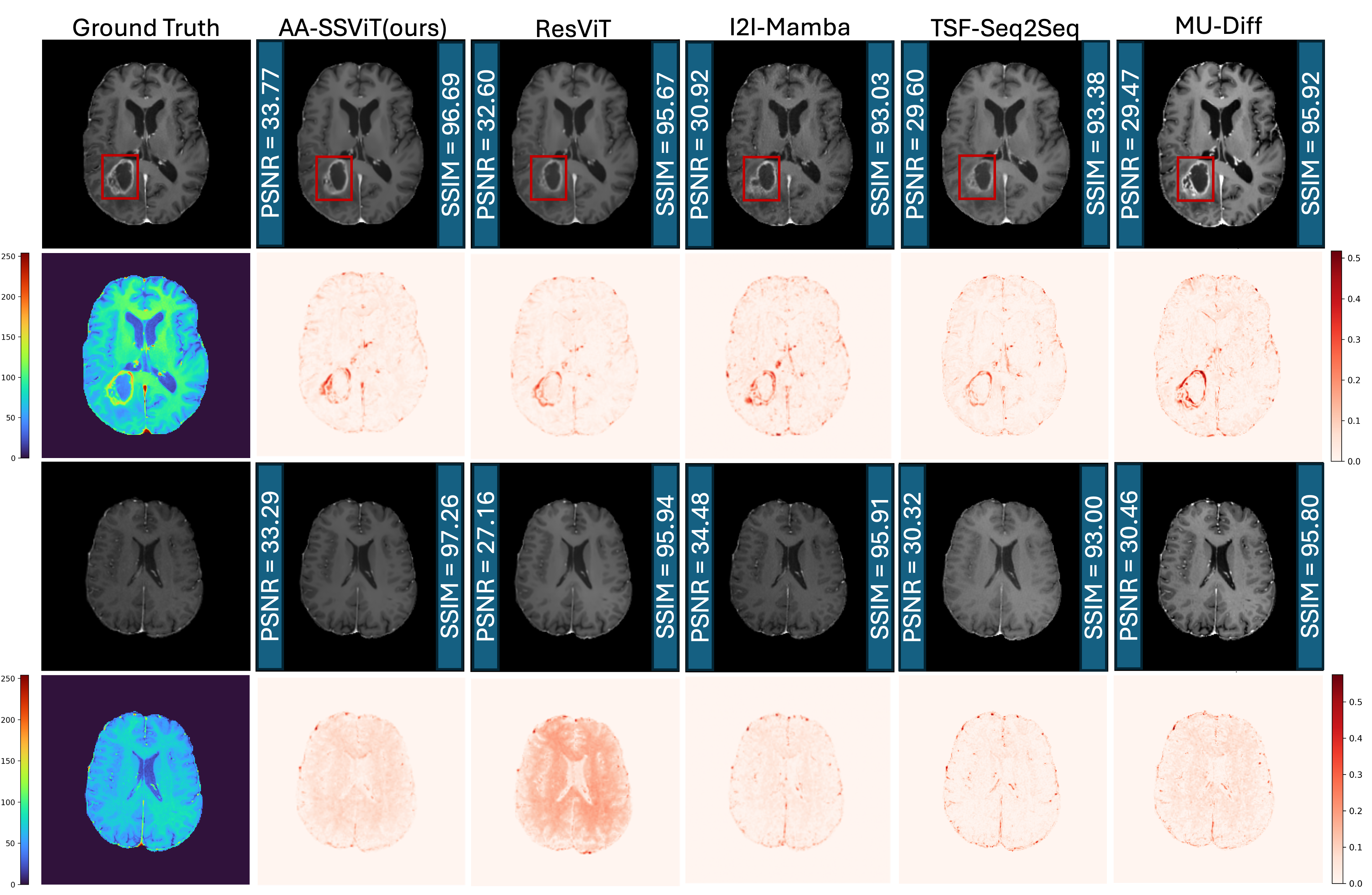 Figure 3: Visualization of cancerous and normal synthesized images with PSNR and SSIM of AA-ViT and baselines (row 1 and 3) and corresponding error maps (row 2 and 4).