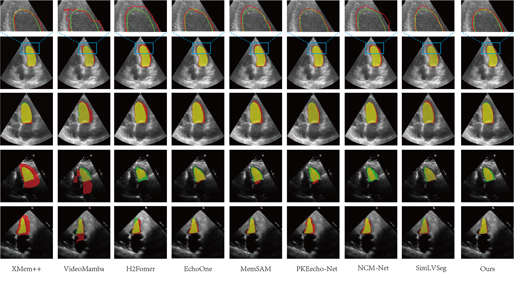 Figure 2: Visual comparison with representative baselines on CAMUS and EchoNet-Dynamic datasets.