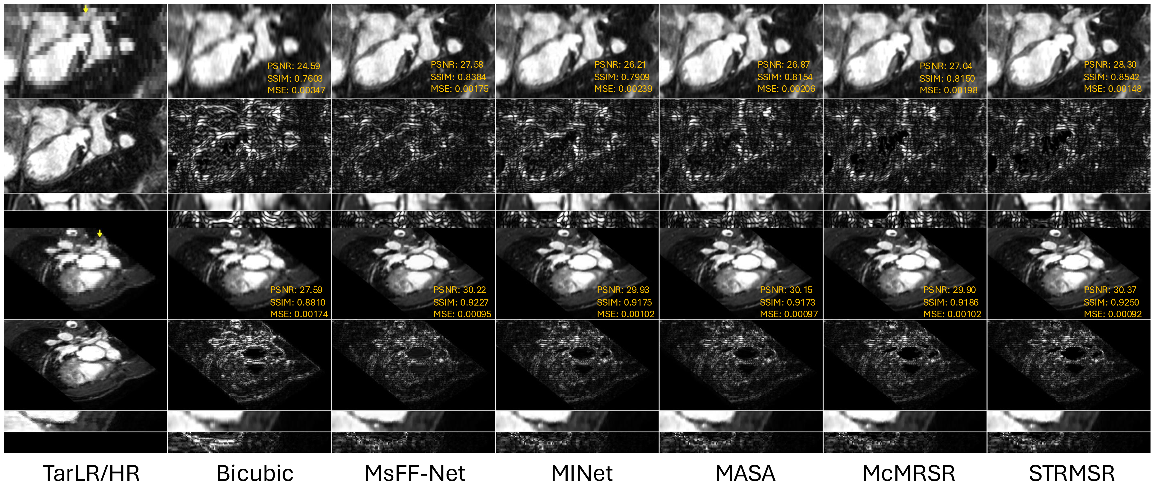 Figure 3: Qualitative comparison under \times​8 SR on WHS-Ortho (rows 1–4) and \times​4 SR on WHS-LAX (row 5–8). Rows 1, 5: SR images; rows 2, 6: error maps; rows 3, 7: temporal profiles at yellow arrows; rows 4, 8: temporal error maps.