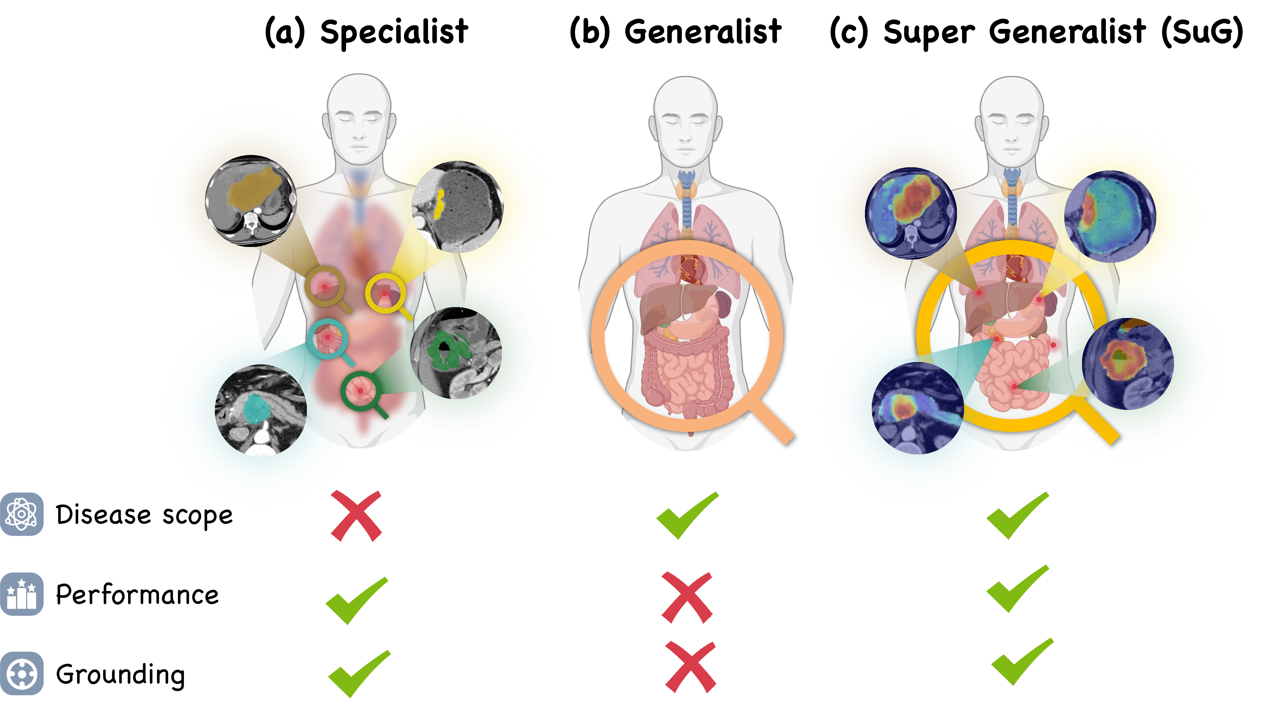 Figure 1: Comparison of medical AI paradigms: Specialist, Generalist, and the proposed Super Generalist (SuG). We evaluate these paradigms across three critical dimensions: disease scope (range of tasks), performance (diagnostic accuracy), and grounding (lesion localization). (a) Specialists excel in performance and grounding but are limited to a narrow disease scope. (b) Conversely, Generalists support a wide scope but suffer from inferior performance and a lack of precise grounding. (c) Our proposed SuG overcomes these trade-offs, achieving high diagnostic accuracy and precise lesion localization across diverse diseases.