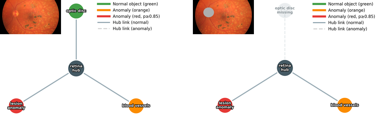 Figure 5: Perturbation-based concept graph auditing in ConceptSMILE. Masking the optic-disc region changes the corresponding concept node and illustrates how concept confidence responds to evidence removal.
