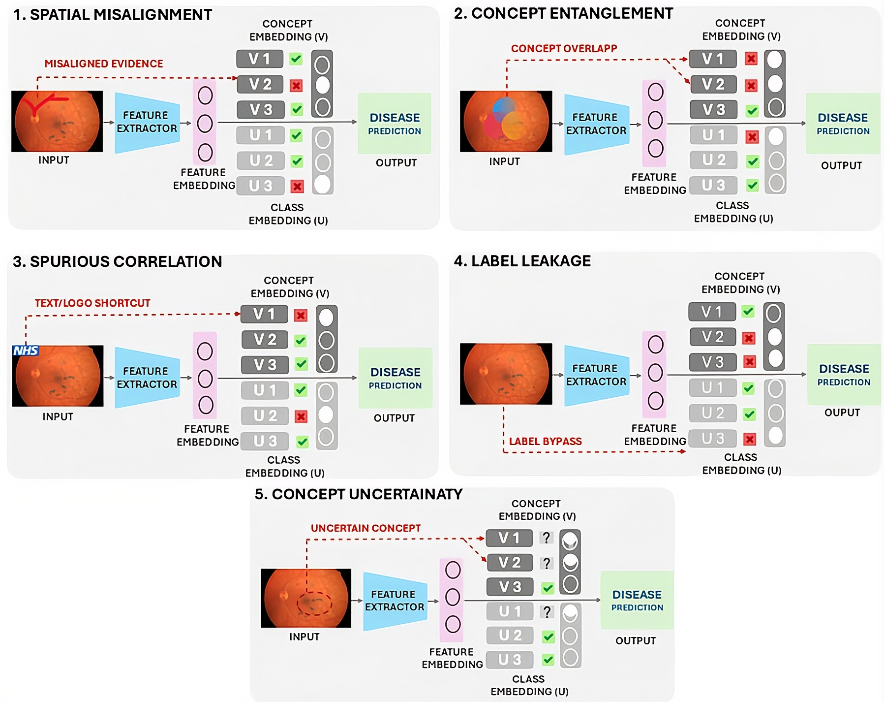 Figure 3: Key reliability challenges in Concept-Based XAI, including spatial misalignment, concept entanglement, spurious correlation, label leakage, and concept uncertainty.