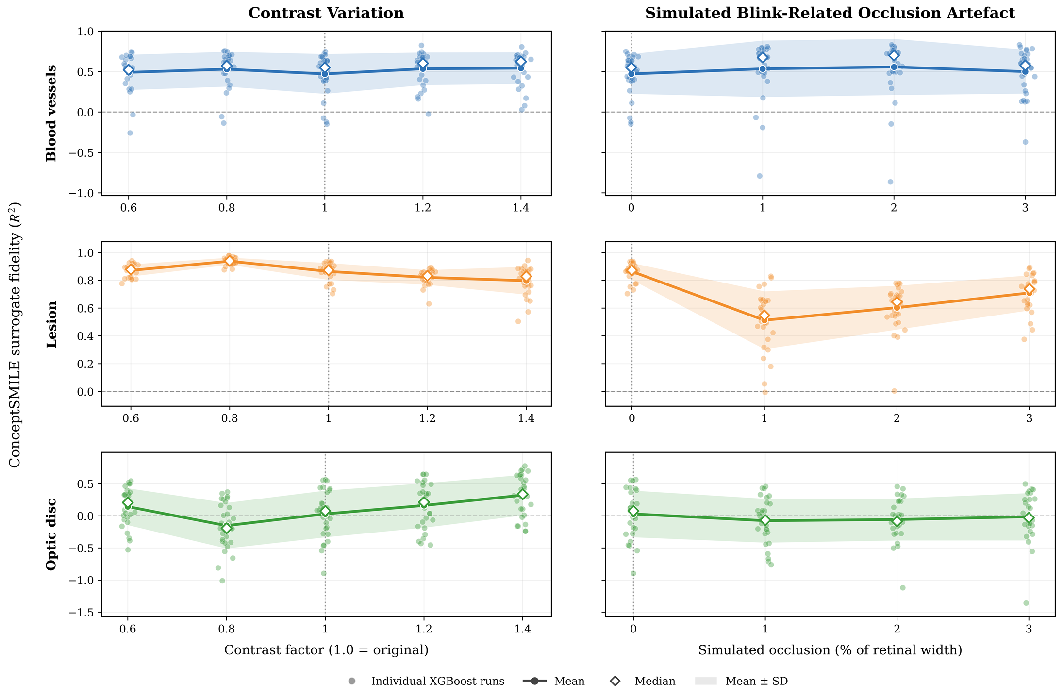 Figure 11: MedSAM-based ConceptSMILE robustness under contrast variation and simulated blink-related occlusion.