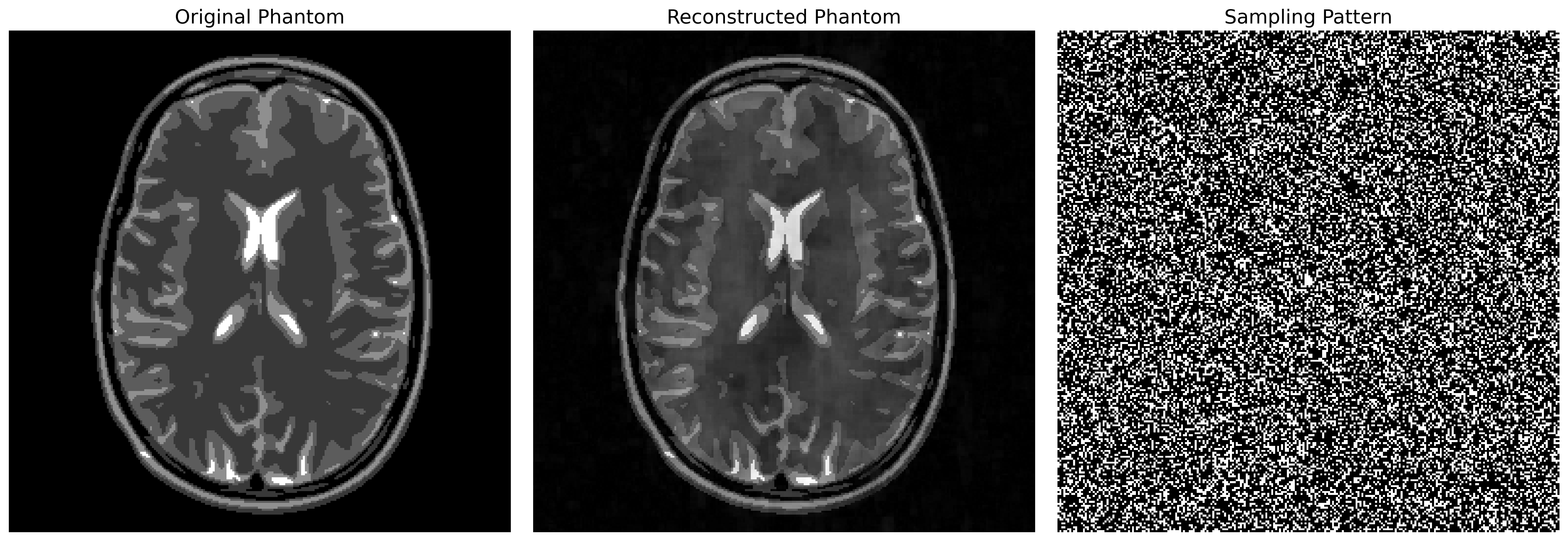 Figure 77: The GLPU MRI phantom (left), its reconstruction (middle) via \ell_1 minimization from 30% discrete randomly chosen Fourier measurements using the wavelet transform as sparsifying transform U. The sampling pattern is depicted on the right where white pixels correspond to sampling locations.