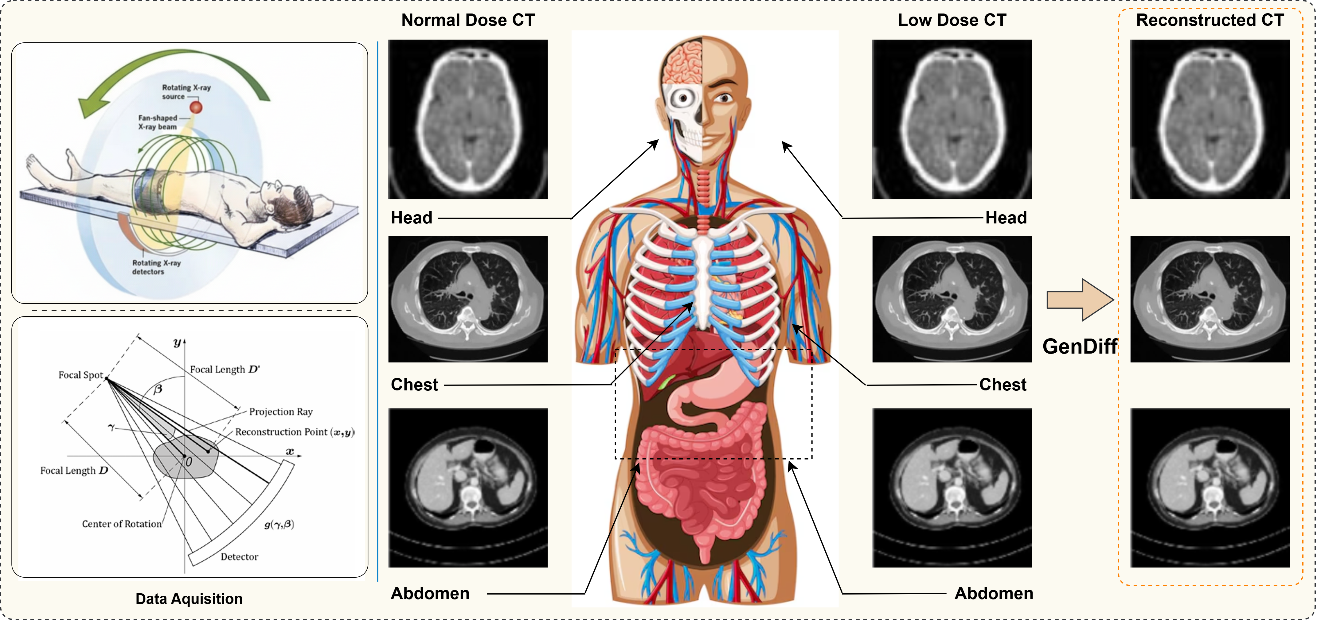 Figure 1: Overview of the proposed GenDiff framework for unified low-dose CT reconstruction. GenDiff integrates doseand anatomy-aware conditioning within a deterministic cold diffusion process to reconstruct high-quality CT images from low-dose inputs. The framework jointly models radiation dose and anatomical region, enforces physics consistency during iterative refinement, and produces robust reconstructions across multiple anatomies and unseen dose levels.