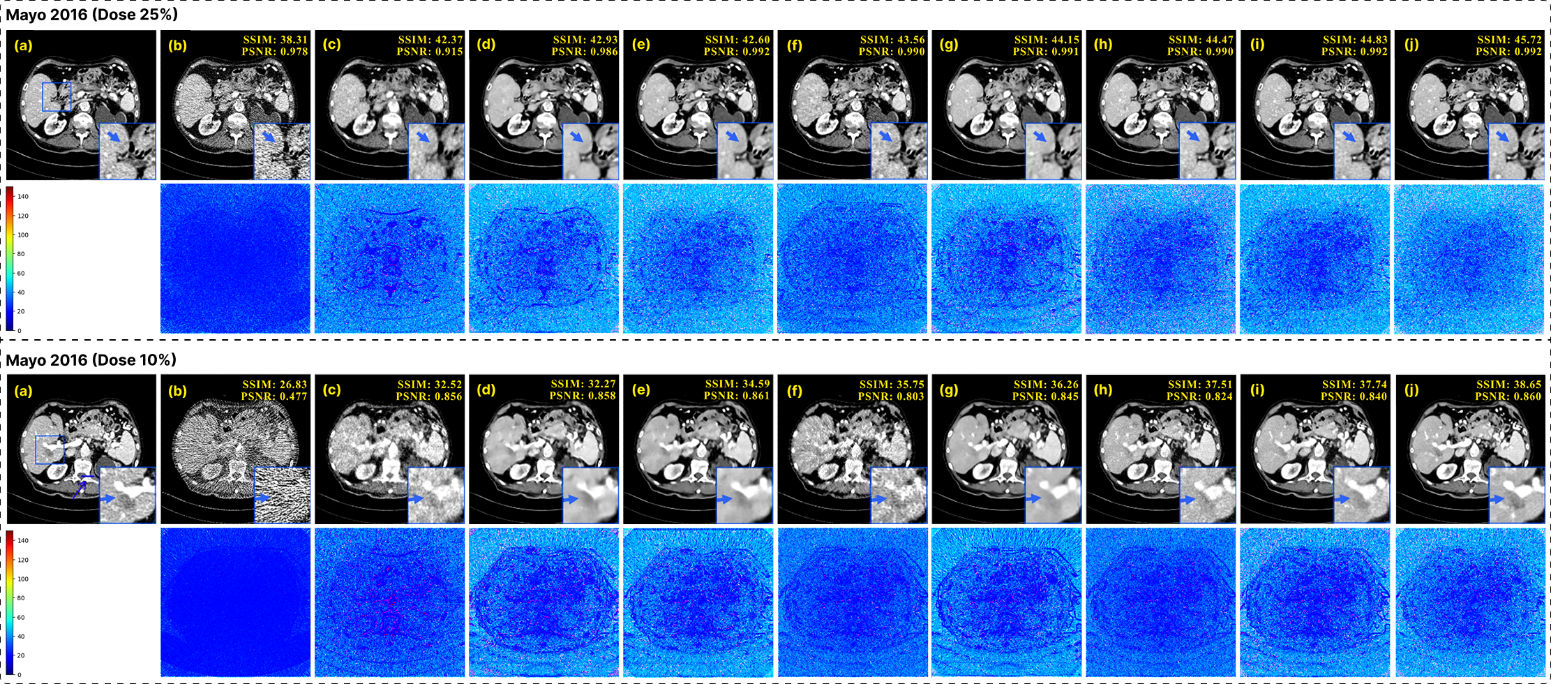 Figure 3: Qualitative comparison on the Mayo-2016 dataset at seen dose levels. Representative abdominal CT slices reconstructed at 25% and 10% dose are shown for the NDCT reference, LDCT input, and competing diffusion-based methods, along with the proposed GenDiff. Zoomed-in regions (blue boxes) highlight local structural details and noise characteristics.