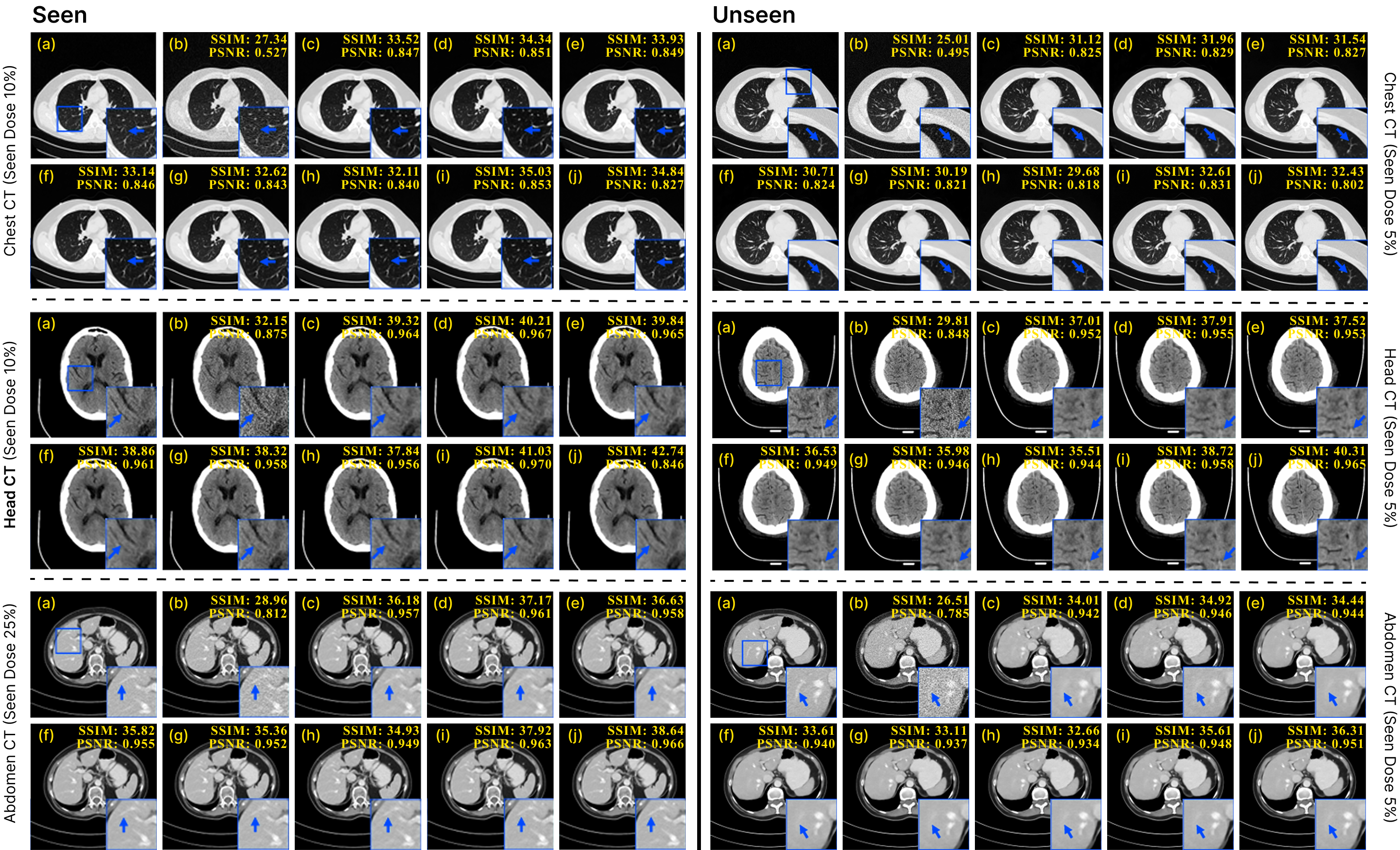 Figure 4: Qualitative comparison on the Mayo-2020 dataset across multiple anatomies and dose levels. Representative axial slices from the chest, head, and abdomen are shown at seen (25%, 10%) and unseen ultra-low (5%) dose settings. From left to right in each group: NDCT reference, LDCT input, representative CNN- and diffusion-based baselines, and the proposed GenDiff. Zoomed-in regions (blue boxes) highlight local anatomical details and artifact patterns.