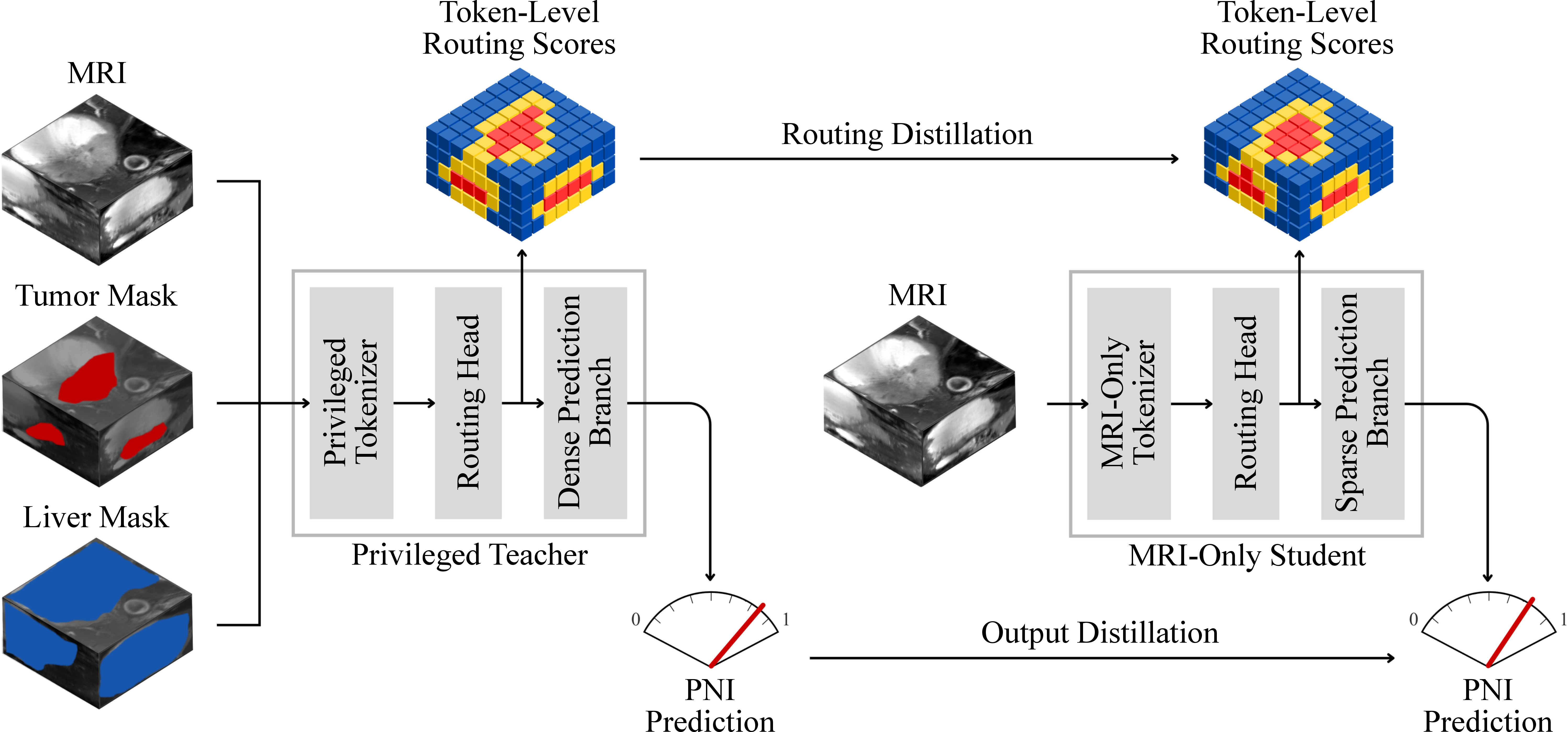 Figure 1: Overview of the proposed framework. During training, the teacher receives MRI together with tumor and liver masks, produces a dense routing distribution over the token grid, and predicts the patient-level label. The student receives MRI only and is trained with supervised learning, routing distillation, and output distillation. At inference, the student retains the top-M tokens and reuses the same routing scores for weighted pooling over the retained tokens.