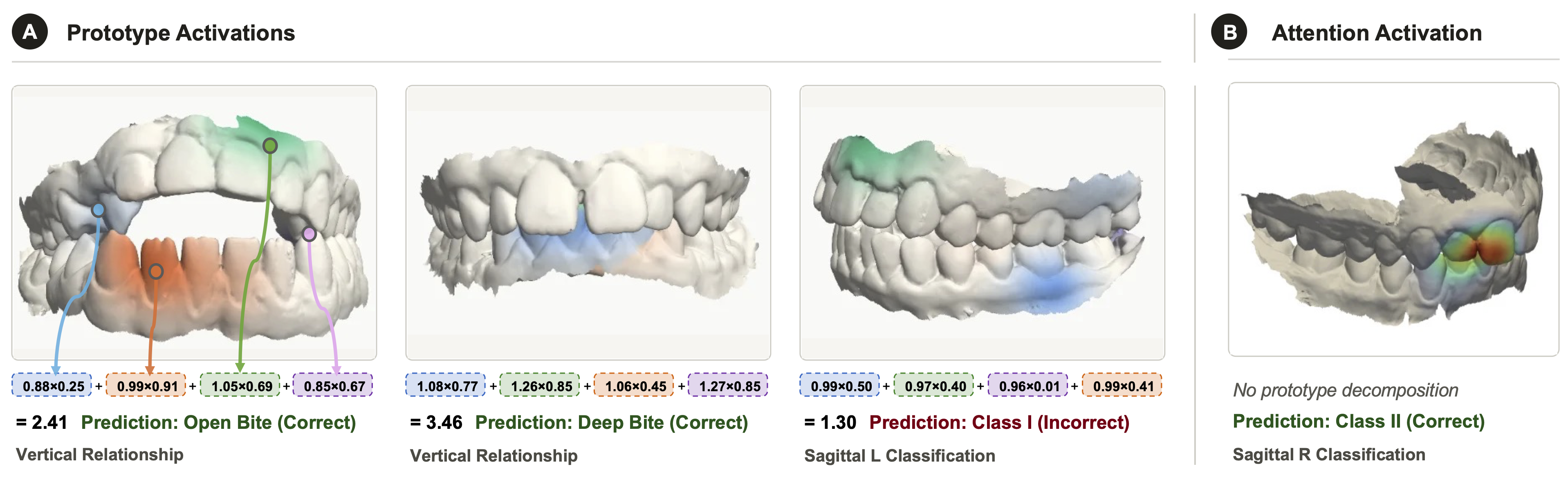 Figure 2: Example prototype-based spatial explanations produced by ProtoPointNet.