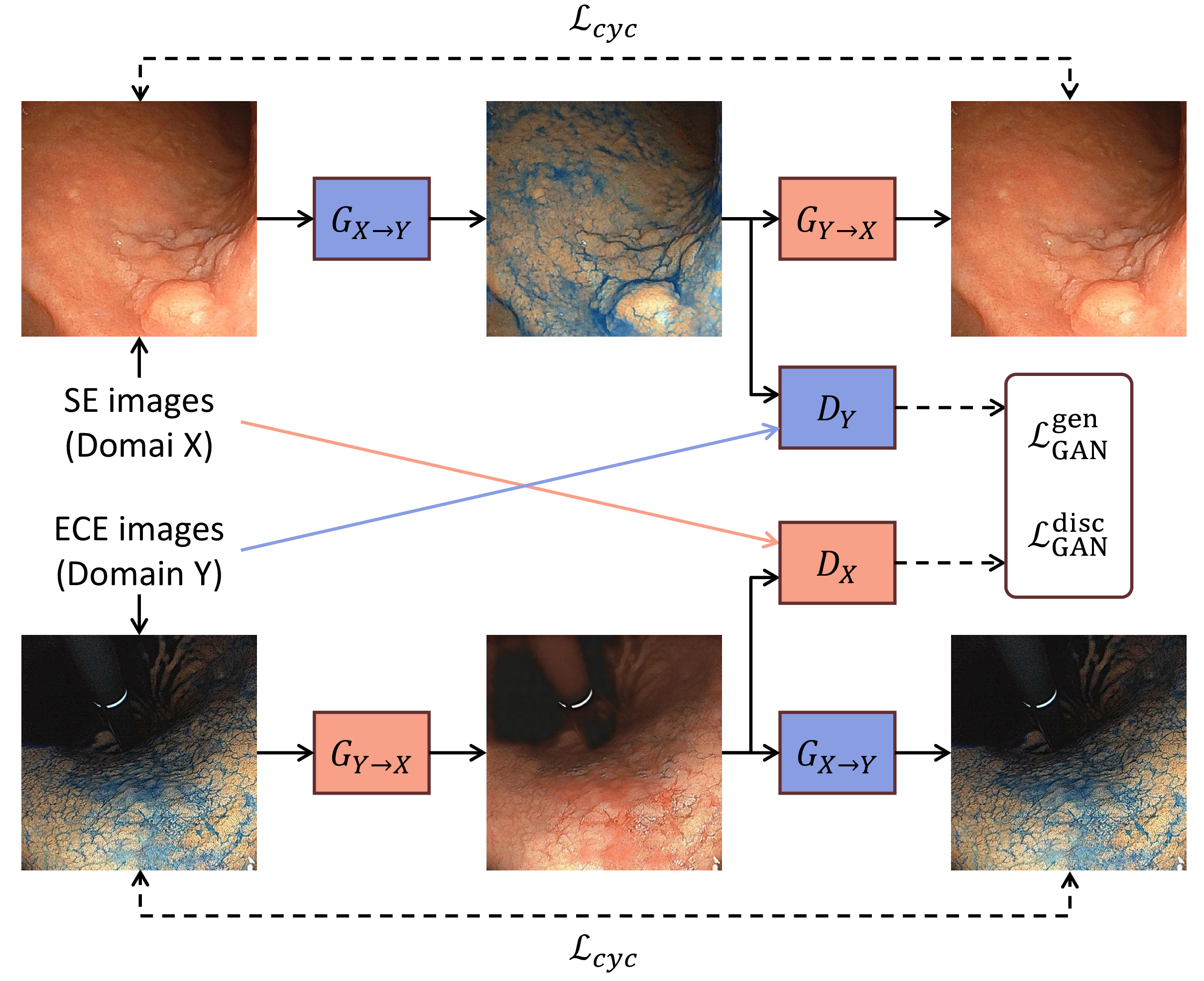 Figure 4: The applied model architecture of CycleGAN.