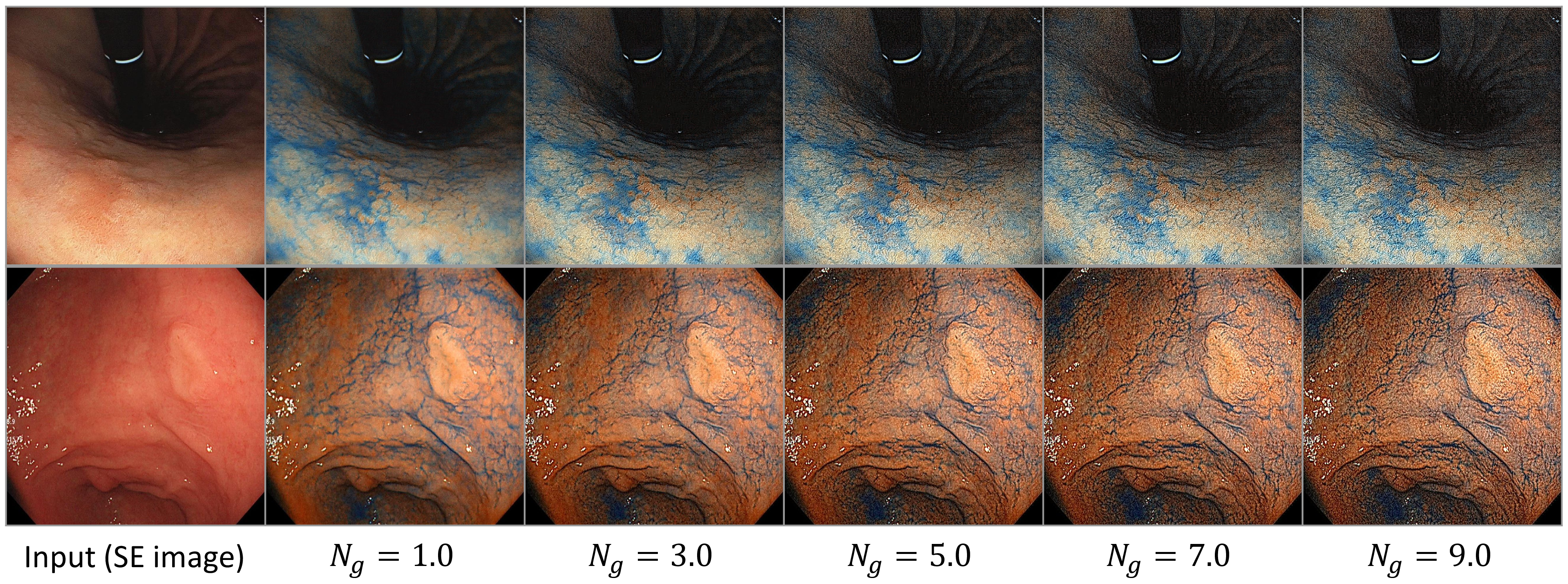 Figure 6: The visual results of the V-ECE image generation by our tunable CycleGAN model. The top row is the results for the Fujifilm dataset, and the bottom row is the results for the Olympus dataset. We can confirm that stronger gradient enhancement is achieved by inputting higher gradient gains.