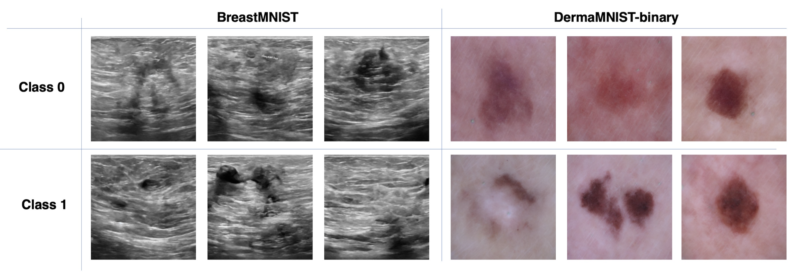 Figure 7: Examples of synthetic images generated by our method for BreastMNIST and DermaMNIST-binary. Each column shows samples from one class, illustrating that the generated images capture class-distinctive visual patterns while maintaining diversity within each class.