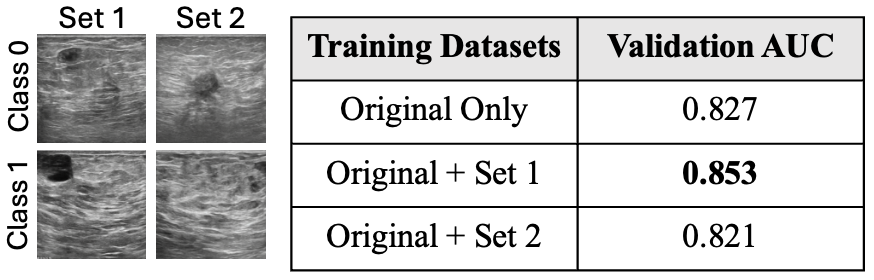 Figure 1: We fine-tune Stable Diffusion on 32 BreastMNIST images per class and generate 20 synthetic images per class for Sets 1 and 2. Original only uses only real images. Set 1 produces stronger classification AUC than Set 2.