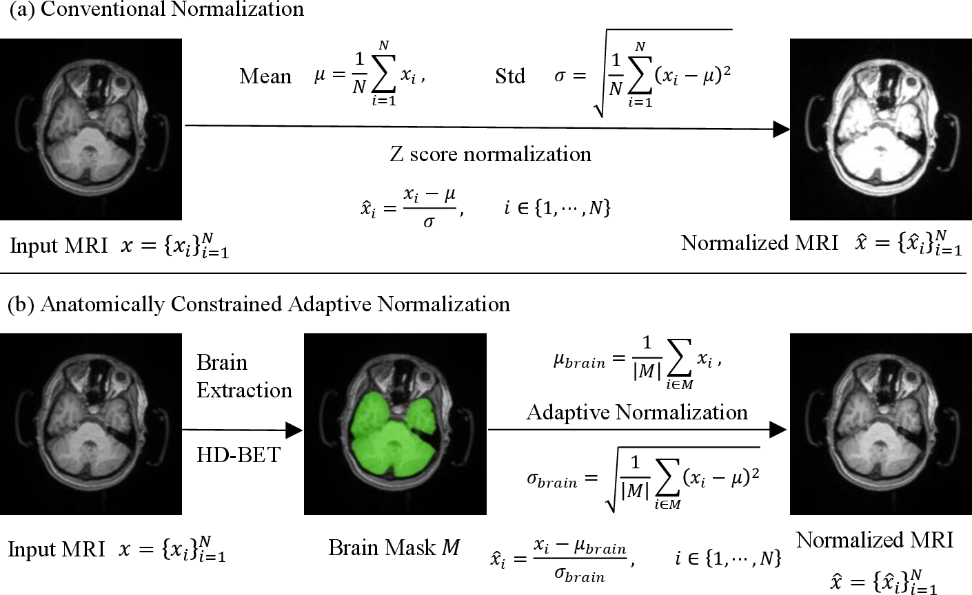 Figure 1: Comparison of normalization strategies within the nnU-Net framework. (a) Conventional normalization computes mean and standard deviation over all voxels, leading to potential variability from non-brain regions. (b) The proposed anatomically constrained adaptive normalization restricts computation to brain parenchyma voxels using a brain mask, thereby reducing inter-subject variance and improving robustness.