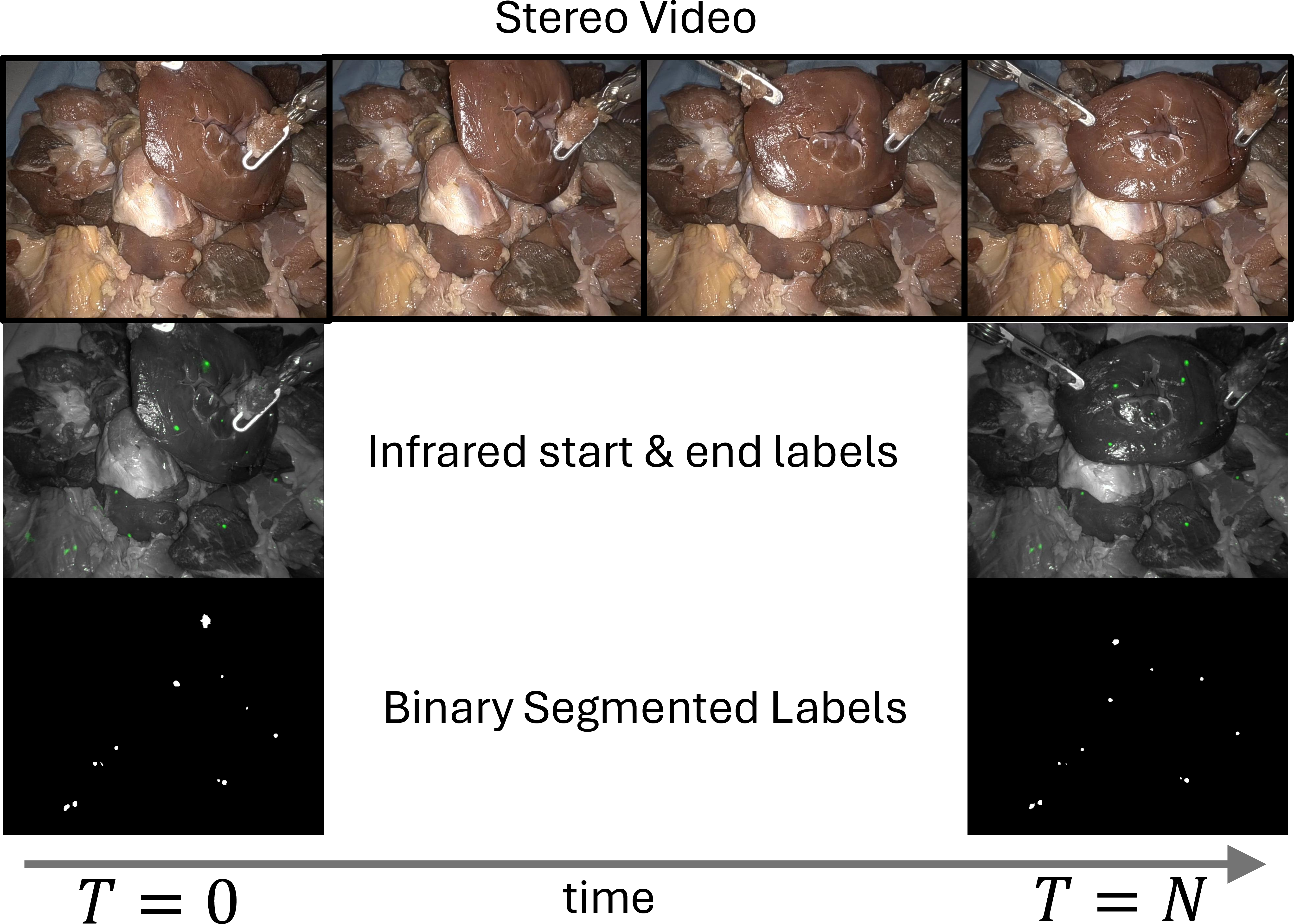 Figure 6: Example ex vivo sequence (session 06, sequence 28) from the STIR Challenge 2025 test set. The start segmentation (middle left) is converted into a set of points (bottom left), that are passed to the algorithm which tracks in the white light stereo video (top). The algorithm results are compared to the ground truth end points (bottom right).