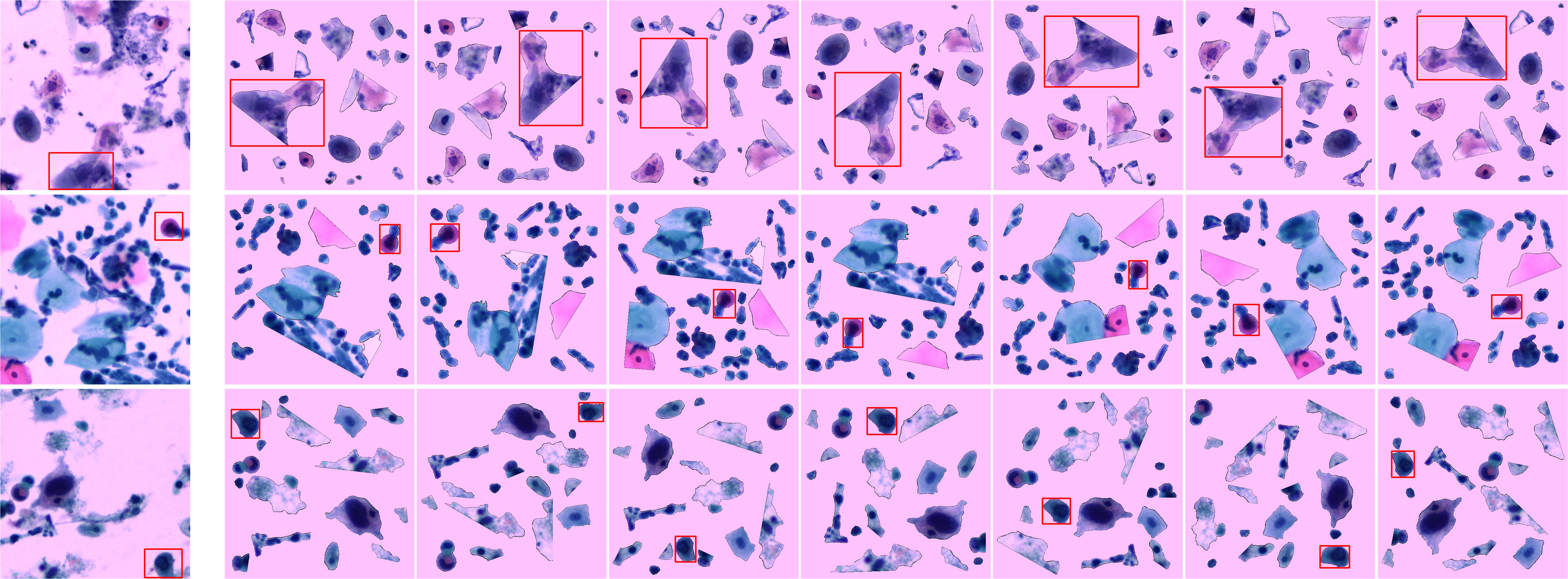 Figure 6: Visual demonstration between original TCT images and their corresponding seven-times C-Norm augmented images. Model robustness is further evaluated on these multi-version C-Norm-processed TCT images.