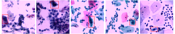 Figure 1: Visual demonstration of severe unevenness in cell population spatial distribution.