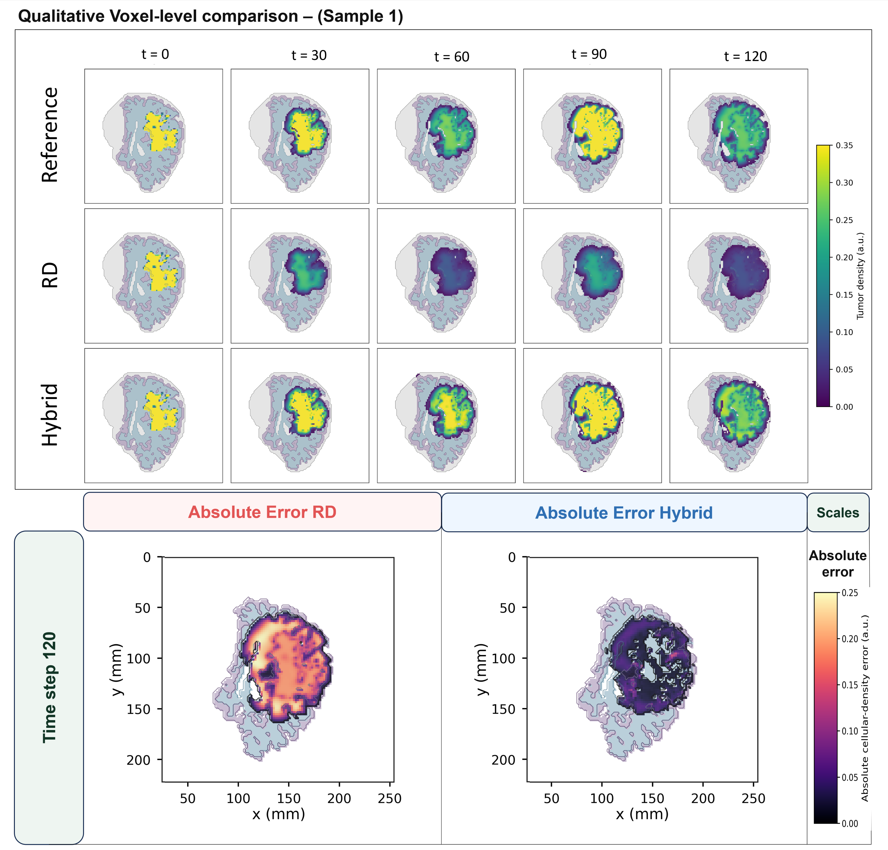 Figure 7: Qualitative voxel-level comparison for patient sample 1 from the dense simulated-observation setting. The top panel shows the reference trajectory, baseline RD prediction, and offline hybrid RD–residual prediction from simulation step 0 to step 120. The bottom panel compares absolute RD and offline hybrid prediction errors at step 120 using a shared error scale. This sample illustrates a compact tumor morphology in which the RD baseline preserves coarse location but underestimates heterogeneous cellularity, whereas the offline hybrid model better recovers internal density structure and reduces spatial error.