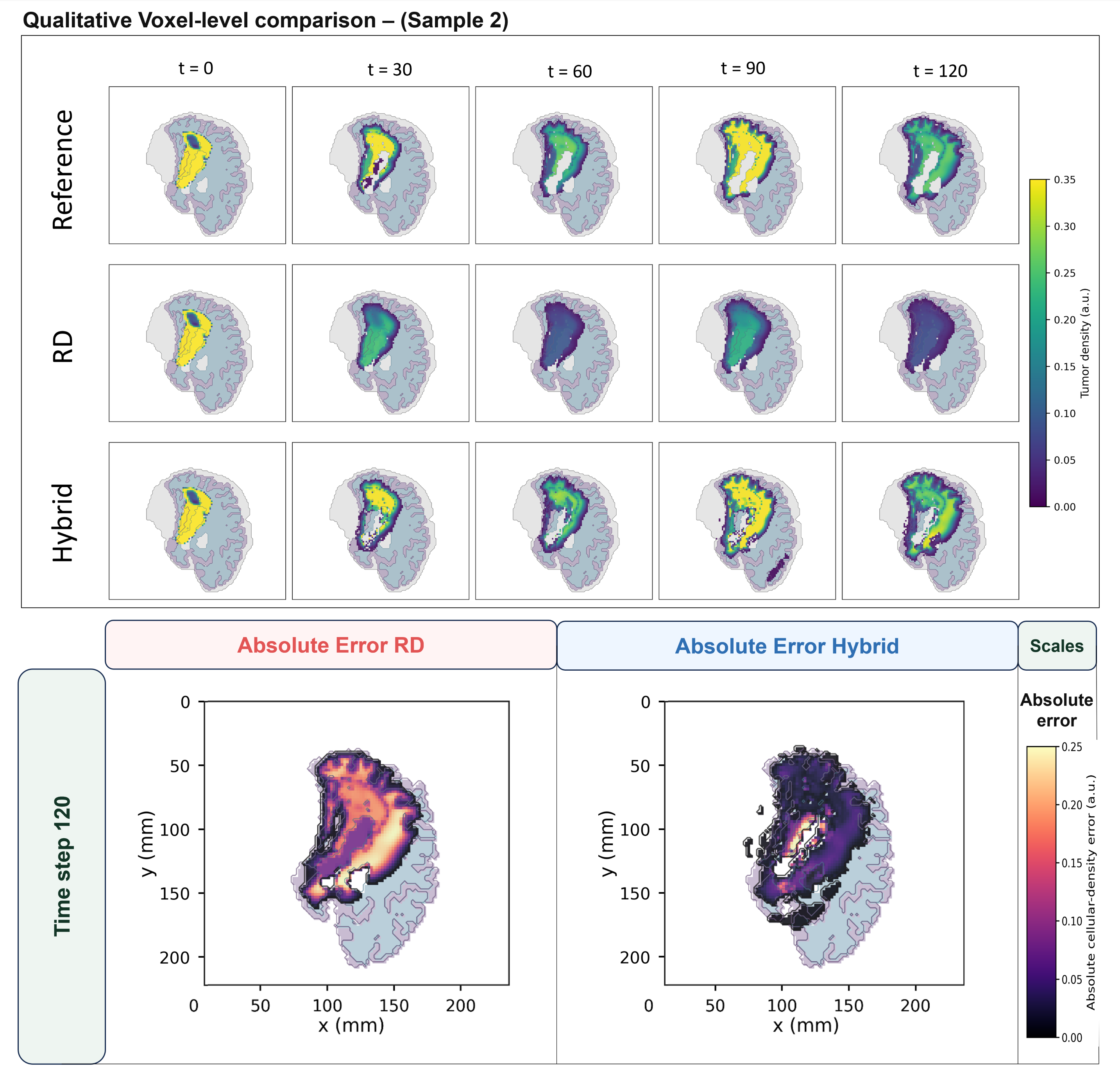 Figure 8: Qualitative voxel-level comparison for patient sample 2 from the dense simulated-observation setting. The layout follows Fig. 7, but the tumor morphology and spatial error pattern differ from patient sample 1. Showing two patient samples emphasizes that the held-out trajectories are not visually identical and that the offline hybrid residual correction reduces RD model-form error across different tumor shapes and cellularity distributions rather than only in a single representative geometry.