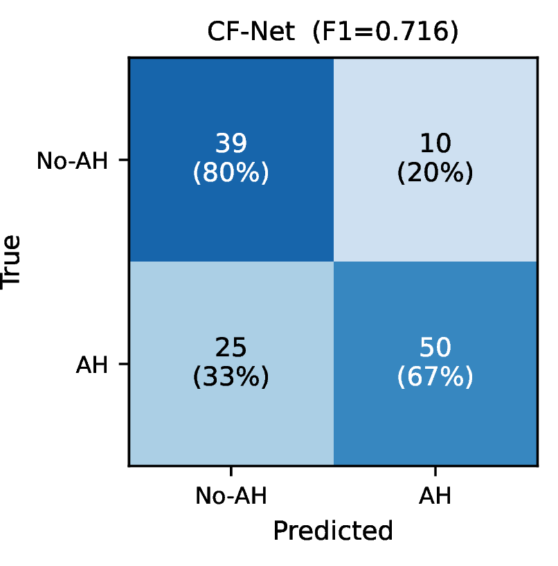 Figure 3: Confusion matrix of CF-Net on the BAH validation set (124 videos). Each cell shows the raw count and row-normalised recall. CF-Net achieves 80% No-AH recall and 67% AH recall.