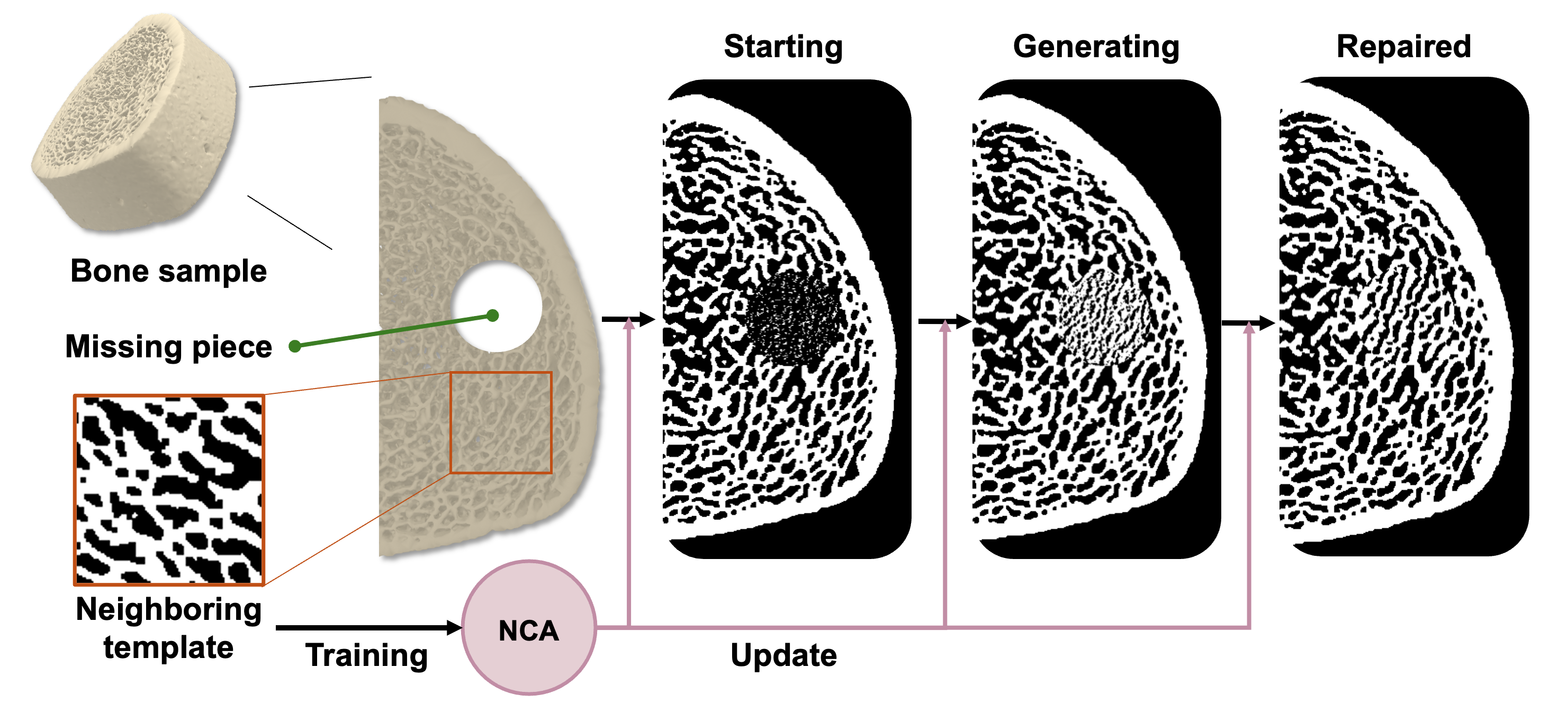 Figure 17: In-situ repair of a damaged trabecular bone microstructure utilizing the NCA generation framework. A circular region is removed from a real cross-sectional bone slice to simulate a localized structural defect. An NCA model is trained on the neighboring region surrounding the defect as the template, learning the local morphology of the surrounding bone microstructure. The repair proceeds by restricting the asynchronous growth to the missing region while the surrounding intact area remains fixed as the boundary condition, allowing the NCA to grow an infill that is seamlessly integrated with the surrounding microstructure at the repair boundary.