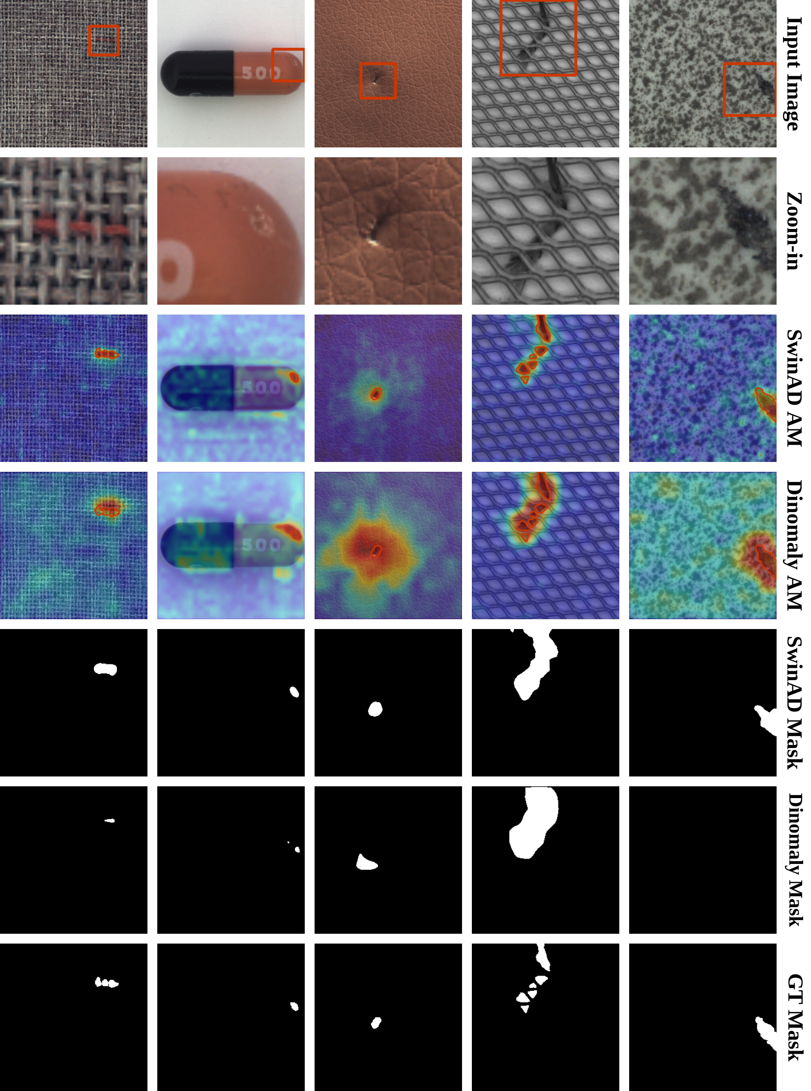 Figure 4: Qualitative comparison of anomaly localization on MVTecAD samples. From top to bottom: input images with annotated defect regions, zoomed-in views of anomalies, anomaly maps (AMs) produced by our proposed SwinAD and Dinomaly, corresponding binary masks after thresholding, and ground-truth (GT) masks. SwinAD generates more compact and precise anomaly responses with fewer background activations, whereas Dinomaly often produces over-smoothed and spatially diffuse predictions, particularly on textured surfaces and elongated defects.