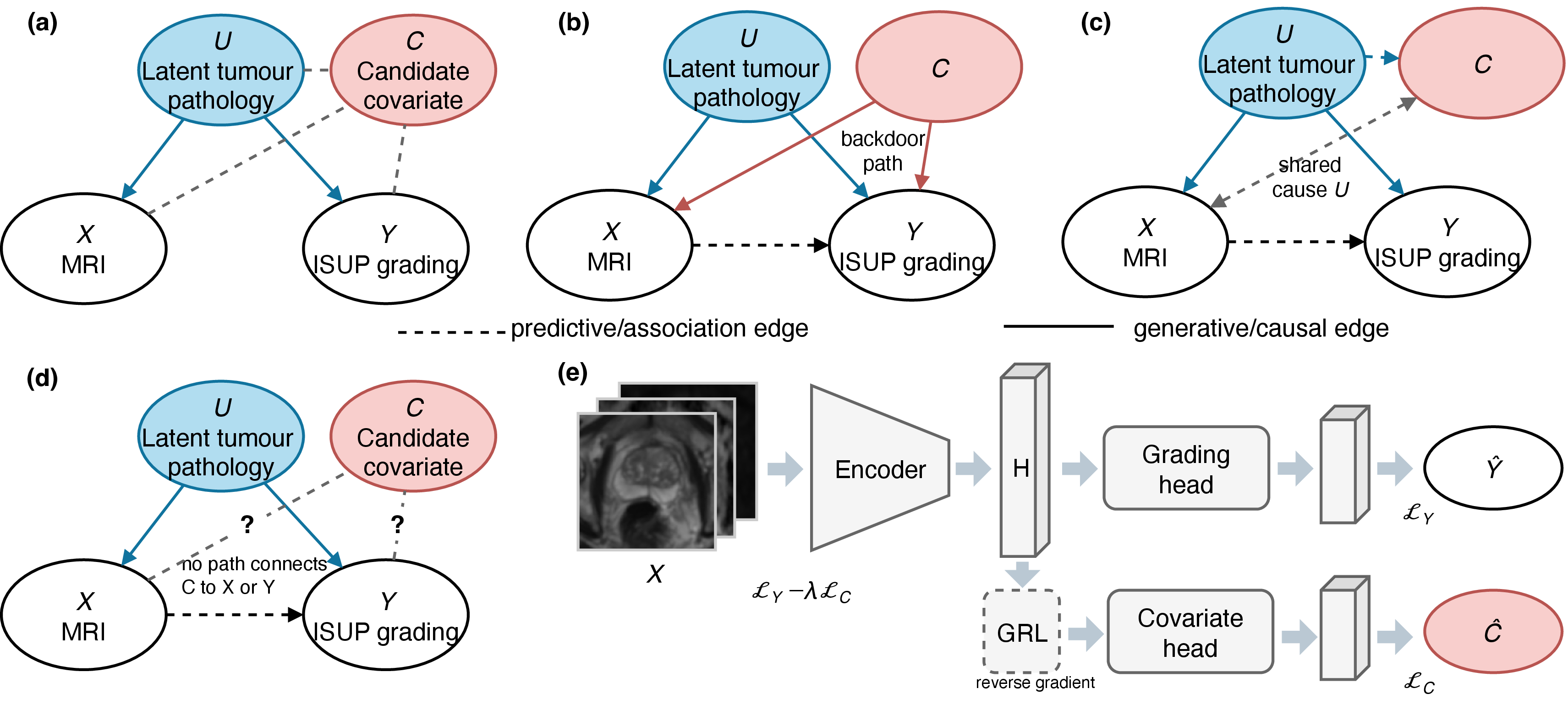 Figure 1: (a) to (d): conceptual hypotheses for candidate covariate C. Blue denotes latent tumour pathology U and biology-related pathways, red denotes the candidate covariate, and white nodes denote observed MRI X and ISUP grade Y. The covariate may act as a shortcut/confounder, a disease-related proxy, or an irrelevant covariate. (e): adversarial invariance model for testing candidate C: an encoder maps X to representation H, a grading head predicts \hat{Y}, and a covariate head predicts \hat{C} through a gradient reversal layer [18], reducing C-decodability while preserving grade-predictive information.