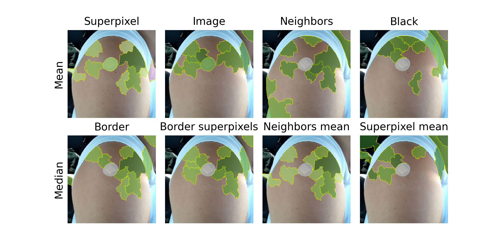 Figure 2: Explanations using 8 deterministic occlusion methods: Applied to an image of class band-aid where default LIME fails to identify the most important superpixel(s). The top ten superpixels by absolute weight are visualized (darker green for a stronger positive contribution). From left to right, we can see the occlusion methods 1-8 as described in Section 2.2.